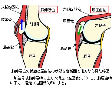 膝伸展位と屈曲位の縦断面略図