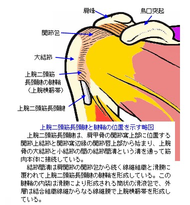 上腕二頭筋長頭腱と腱鞘の略図
