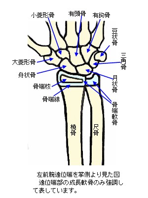 成長期の前腕遠位端掌側面略図