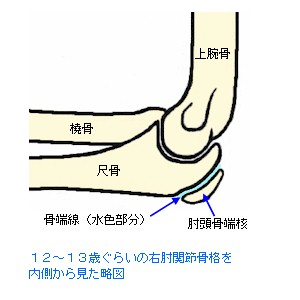 １２〜１３歳の肘関節骨格略図