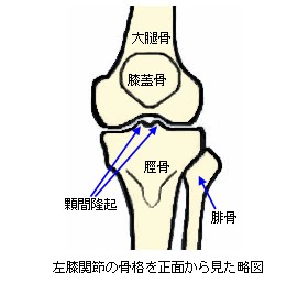 左膝関節の骨格略図