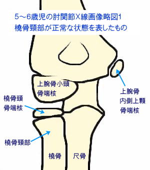 ５〜６歳児の肘関節Ｘ線画像略図