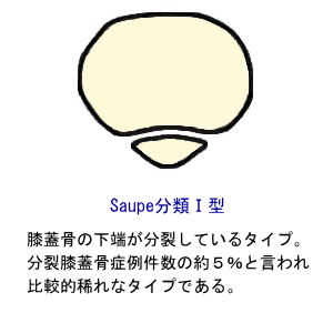 Saupe分類１型