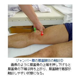 ジャンパー膝の圧痛点の取り方