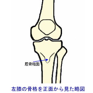 左膝骨格略図