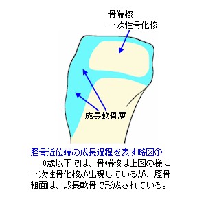 脛骨近位端成長軟骨略図１