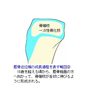 脛骨近位端成長軟骨略図２