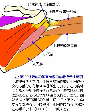 右上腕９０度外転生における腋窩神経の位置を示す略図
