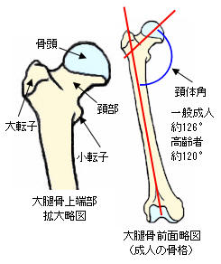 大腿骨の頚体角