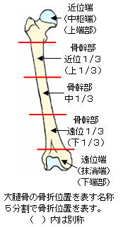 大腿骨の骨折位置を表す名称