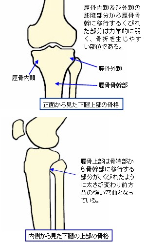 下腿上部の骨格略図