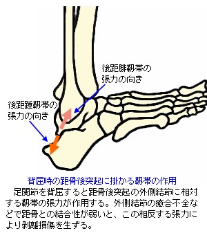 足関節背屈時の距骨後突起に対する靭帯の作用