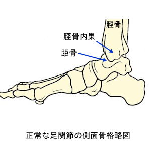 正常な足関節の内側面骨格略図