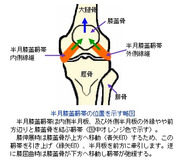半月膝蓋靭帯の位置を示す略図