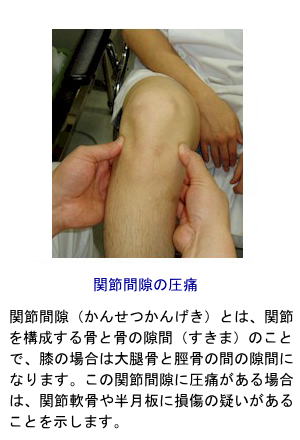 膝関節間隙の圧痛