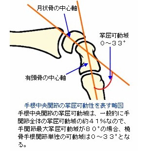 手根中央関節の掌屈可動性
