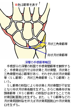 深層の手根靭帯略図