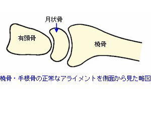 橈骨・手根骨の正常アライメント