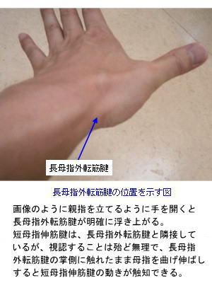 長母指外転筋の位置を示す図