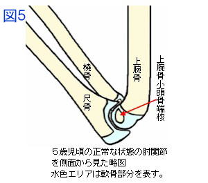 ５歳児の正常な肘関節側面骨格図