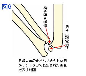５歳児の正常な肘関節側面X線略図