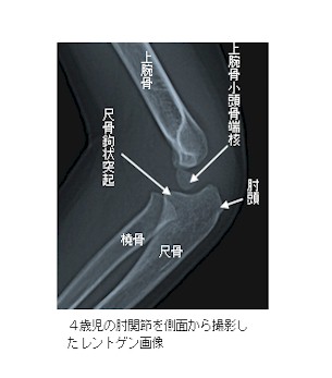 4歳児の肘関節側面Ｘ線画像